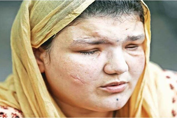 যে কারণে আফগান নারী পুলিশকর্মীর চোখ উপড়ে নিয়েছিল তালেবান